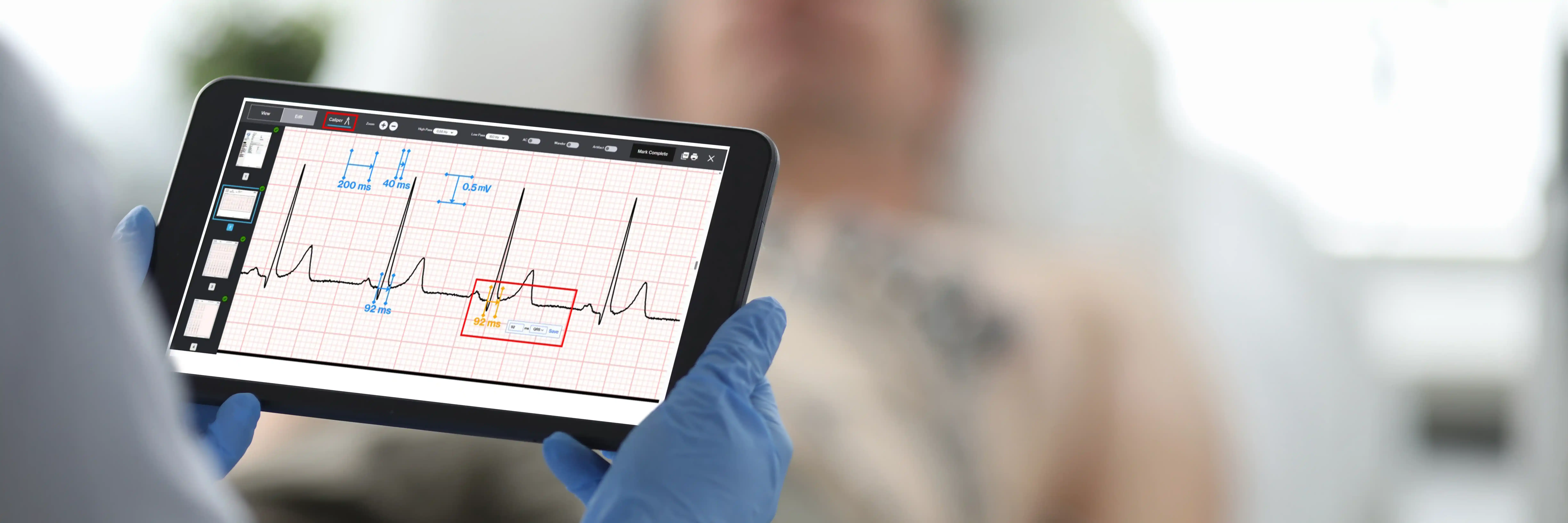 MyoVista® Insights™ Dashboard - AI-ECG Analysis Interface
